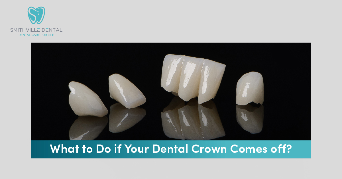 What to Do if Your Dental Crown Comes off? | Smithville Dental