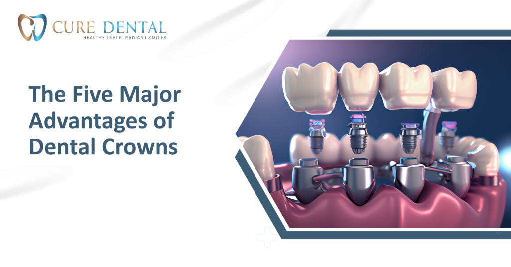 The Five Major Advantages of Dental Crowns | Cure Dental
